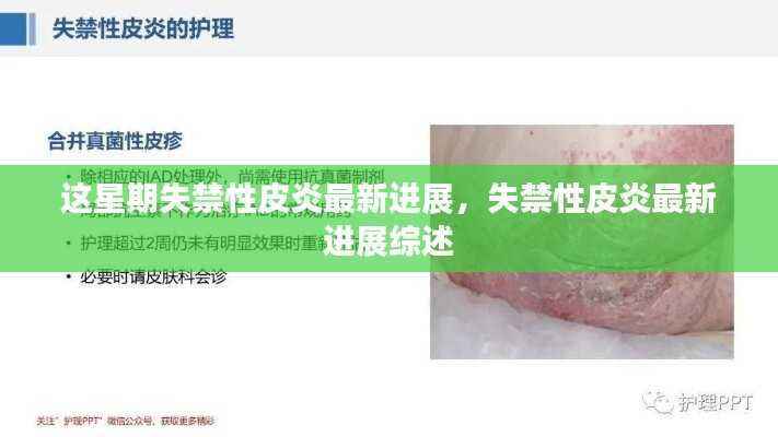 失禁性皮炎最新进展综述,本周最新研究成果概览