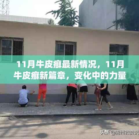 11月牛皮癣最新动态,变化中的力量与自我成就之路