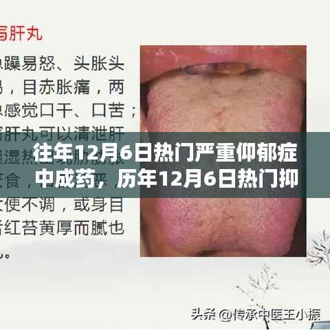 历年12月6日热门抑郁症中成药概览,寻找最适合你的疗愈良药选择