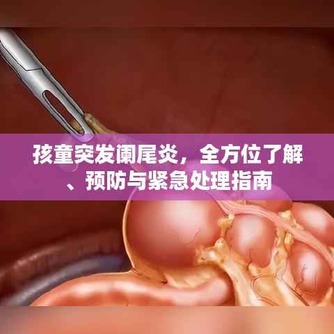 孩童突发阑尾炎,全方位了解、预防与紧急处理指南