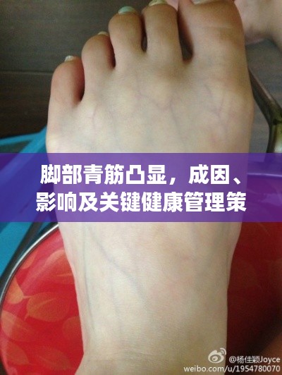 脚部青筋凸显,成因、影响及关键健康管理策略
